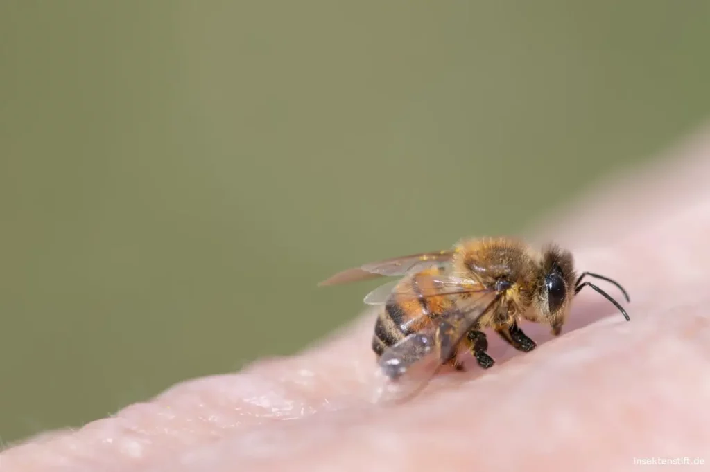 Wie lange dauert die Heilung eines Bienenstichs?