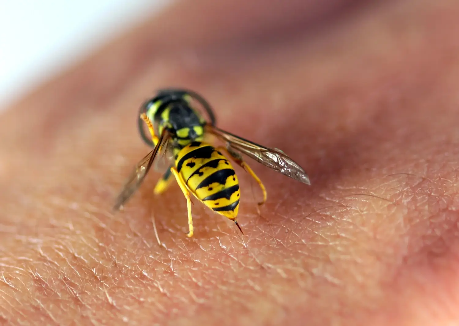 Wie erkenne ich, ob ich allergisch auf Wespenstiche reagiere?